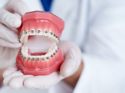 矯正治療について