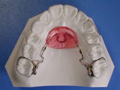 ホールディングアーチ(NHA)